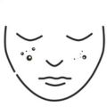 Acne Scars (Deep & Shallow)